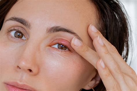 7 Safe Warm Compress Techniques For Eyelid Bumps