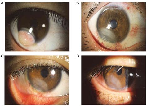 Experimental and Therapeutic Medicine
