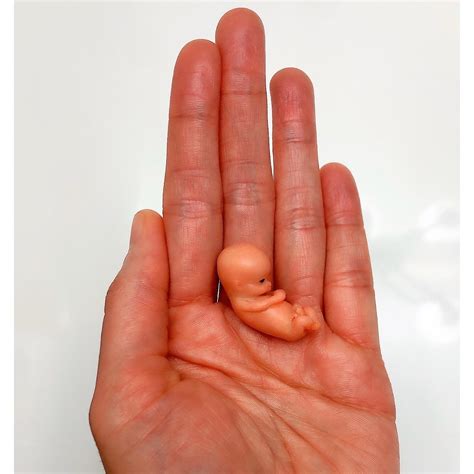 MADE TO ORDER 10 Week Gestation Fetus, Stage of Fetal Development ...