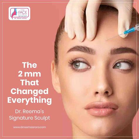 Botox Fillers 2026: Everything You Need to Know Before Treatment