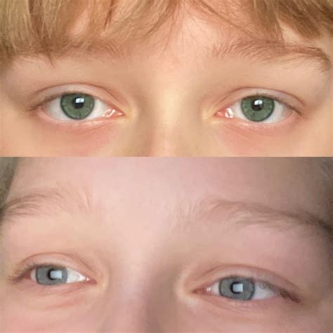 1 year of eye colour subliminal top is after bottom is before. : r ...