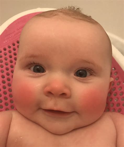 Infant Red Cheeks Teething