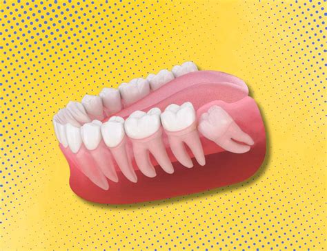 Why Are They Called Wisdom Teeth? Everything - Toronto Dental Clinic