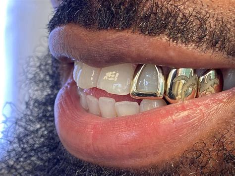 Window/open Face Grillz! Silver, Gold FREE Shipping! - Etsy UK | Grillz ...