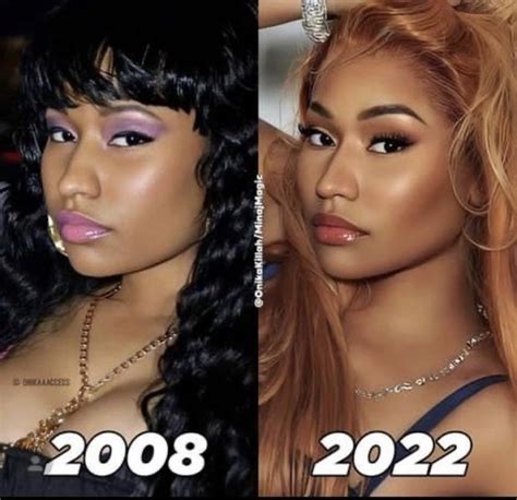 Nicki Minaj Before And After Nose Job