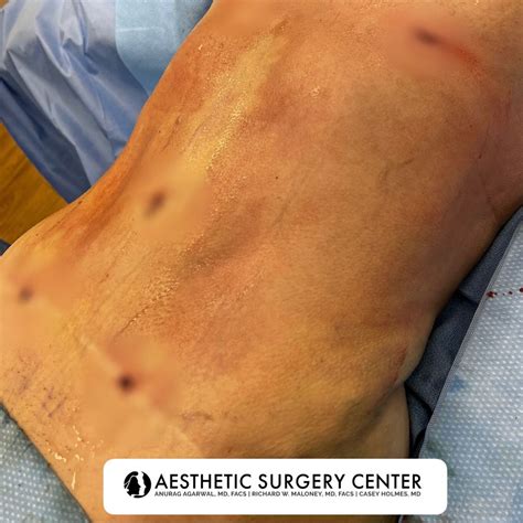 Aesthetic Surgery Center Anurag Agarwal Md Facs Naples Reviews