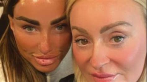 Katie Price shows off her sunburnt lips as she undergoes £195 'facelift' treatment | The US Sun