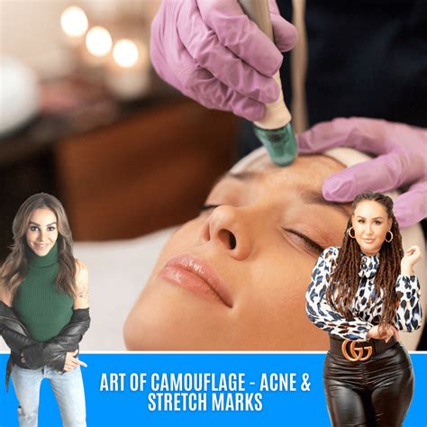 ART OF CAMOUFLAGE - ACNE & STRETCH MARKS – jadorebrows