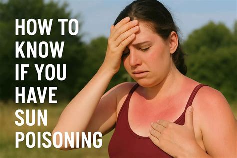 How to Know If You Have Sun Poisoning: 8 Key Signs | Credihealth
