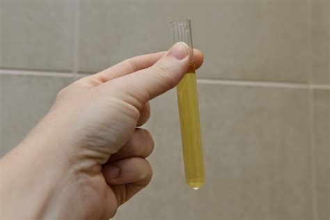 How Do You Get Urine Sample From A Cat at Piper Paltridge blog