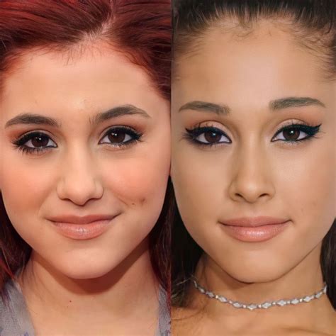 Ariana Grande Surgery