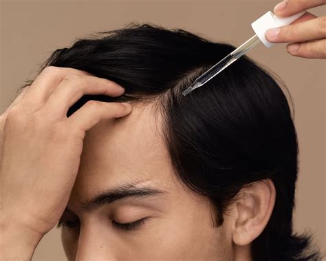 What Is an M-Shaped Hairline? Causes and Solutions | Good Health by Hims