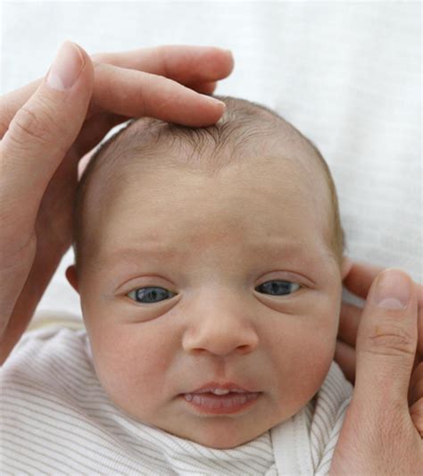 Sunken Eyes In Infants