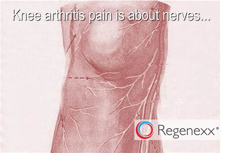 Nerves In the Knee Joint: More Evidence that the Pain of Arthritis is ...