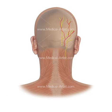 Types Of Occipital Nerves , Occipital neuralgia: Symptoms, causes, and ...