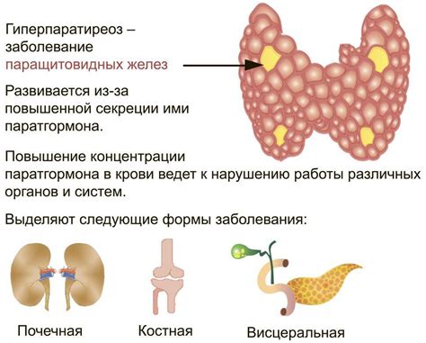 Первичный гиперпаратиреоз — МОСГОРМЕД – запись к врачам в Москве