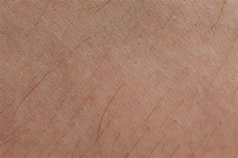 Chafing Unveiled: Decoding the Visual Spectrum of Skin Irritation - What Does Chafing Look Like ...