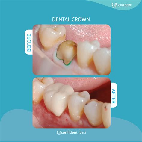 Confident Bali Dental Clinic - Best Dentist in Bali