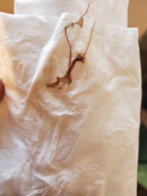 Brown Discharge Implantation Bleeding