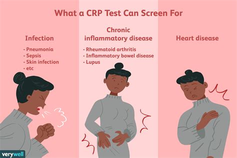 Crp 5 Mg L : C-Reactive Protein Level Chart for Rheumatoid Arthritis – QMHAN