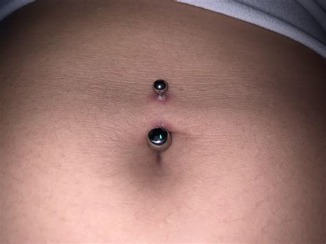 Infected Belly Button Piercing Bubble