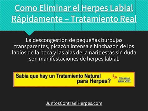 PPT - Como eliminar el herpes labial rápidamente – tratamiento real PowerPoint Presentation - ID ...