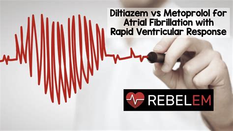 Journal Update - Beta Blocker vs. Calcium Channel Blocker for Rate Control in Atrial ...