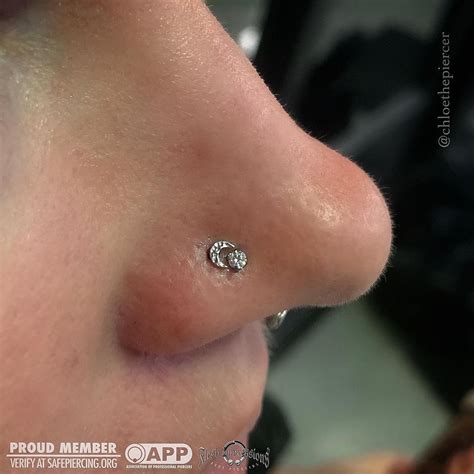 Nostril Piercing Infection