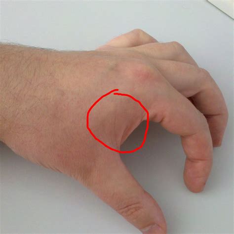 Index Finger Twitching