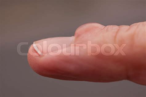 Small round or oval bumps on a finger near a nail. In latin: Myxoid ...