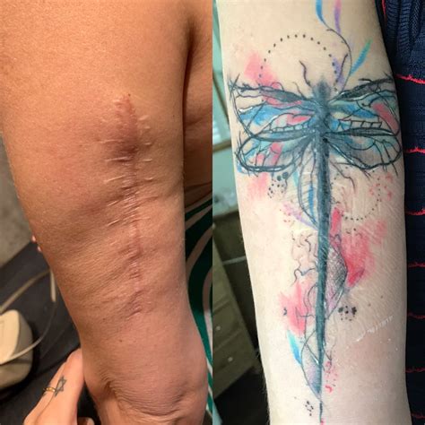 211 amazing tattoos that turn scars into works of art – Artofit