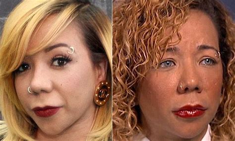 Tiny Harris Face Surgery