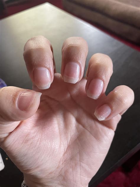 Help! I think my nails are lifting from the nail bed. Is my only option to cut them down?? What ...