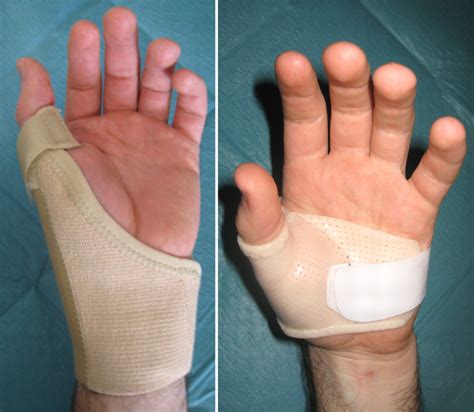 Arthritis Pain Base Of Thumb at Kenneth Hightower blog