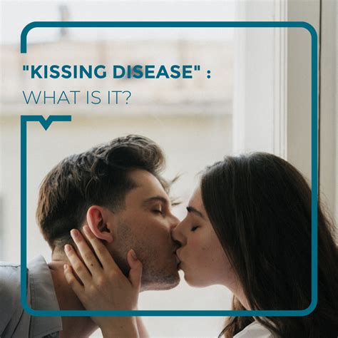Infectious Mononucleosis or kissing disease (Glandular Fever) - Alegria Medical Centre