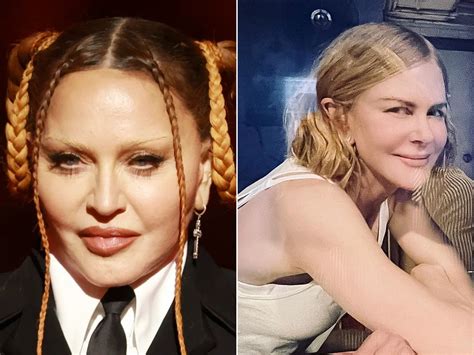 Nicole Kidman Plastic Surgery Face Did Nicole Kidman Have Plastic