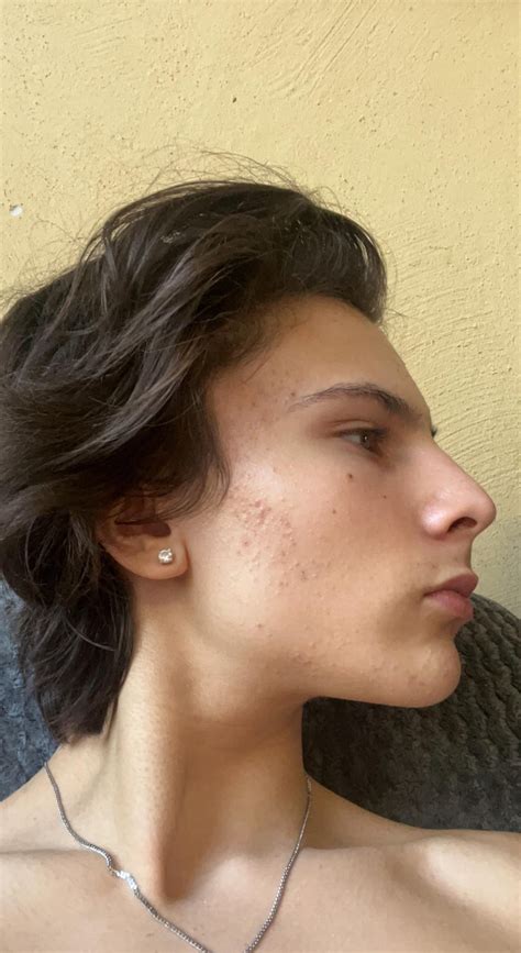 How Can i fix my side profile, i have a good jaw line but something ...