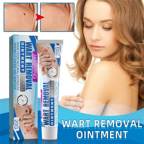 Skin Tag Remover Wart Remover Oitment Easy to Carry for All Skin ...