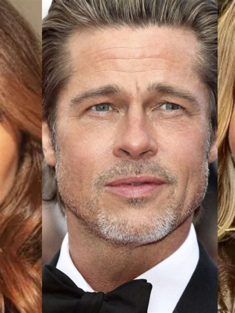 Lifting Facial Antes E Depois Das Celebridades Entenda Novo Protocolo