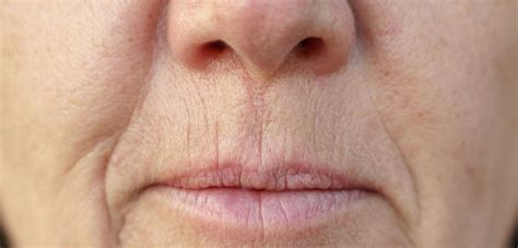 Frowning Lips: Causes, treatment options, and maintenance