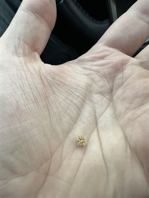 Passing Kidney Stones Passed My First Stone Ever With The Jump And