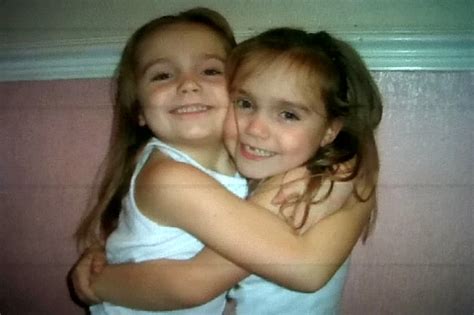 Identical twin sisters Lyndsey and Louise Scott share inseparable bond