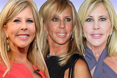 Vicki Gunvalson Before And After