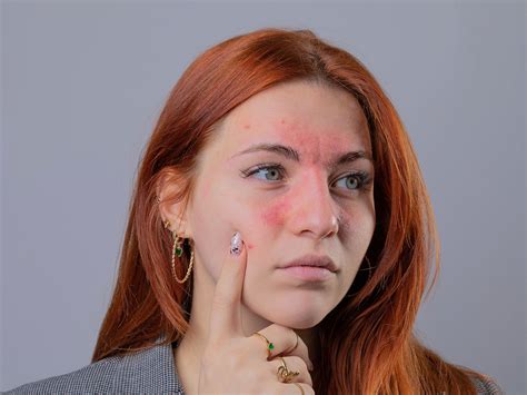 Aesthetic Nurse Practitioner Salary in 2025 | Hubmed