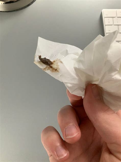 Did my gecko vomit? Today I woke up to this big poo like thing, but it ...