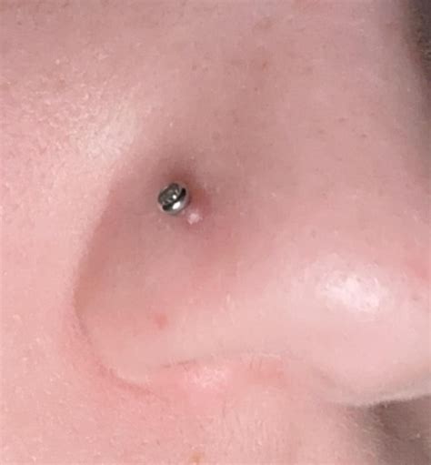 irritation? bump on nose piercing pls help : r/PiercingAdvice