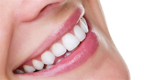 Yellow teeth (yellow spots on teeth): cause, treatment, prevention