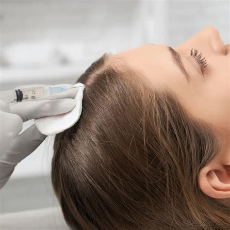 PRP Hair Restoration - Kure Aesthetics