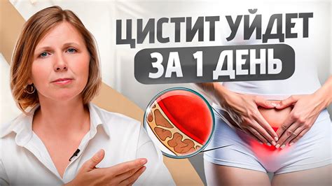 Вот как можно вылечить ЦИСТИТ в домашних условиях! Результат за 24 часа ...
