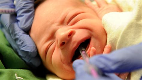 Infant Shuddering Syndrome Symptoms - Quotes Viral Update